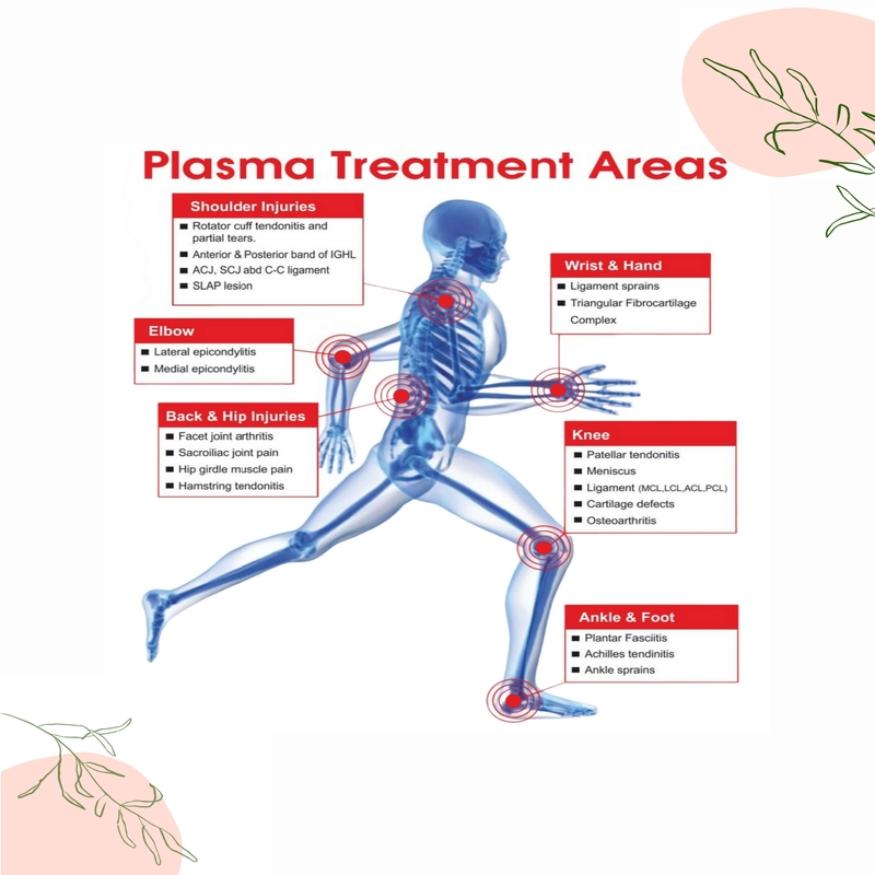 plasma treatment